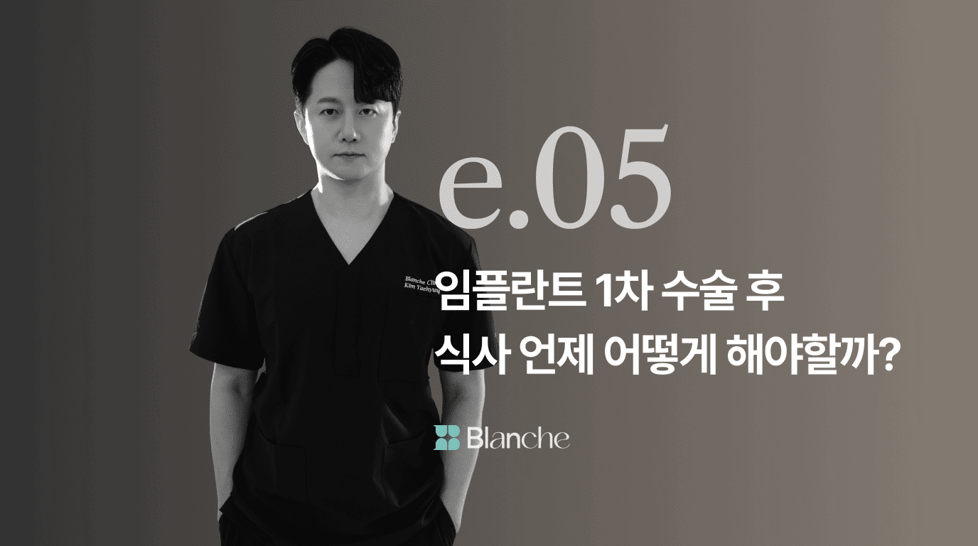 임플란트 1차 수술 후 식사 언제 어떻게 해야할까? 수술당일 음식부터 회복기 식단까지 완벽정리