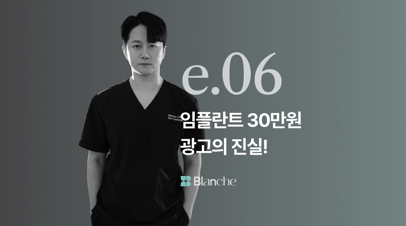 임플란트 30만원 광고의 진실! 숨은 비용부터 합리적인 병원 선택까지