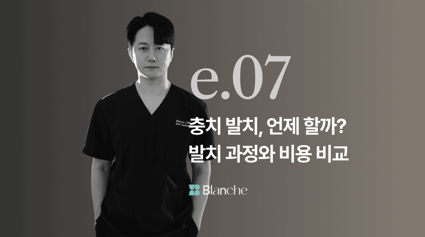 충치 발치 언제 해야 할까? 통증 없는 발치 과정와 비용 비교