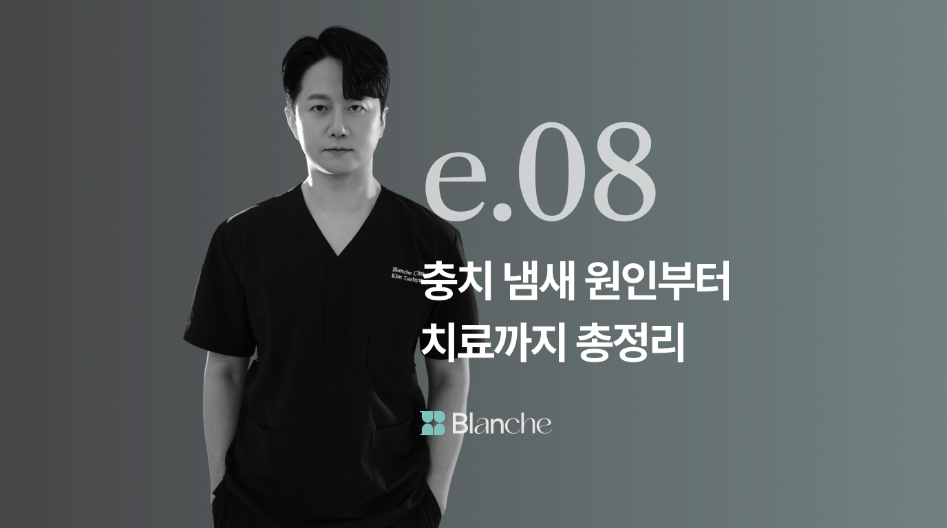 충치 냄새 원인부터 치료까지 입냄새 사라지는 치과 관리법 총정리