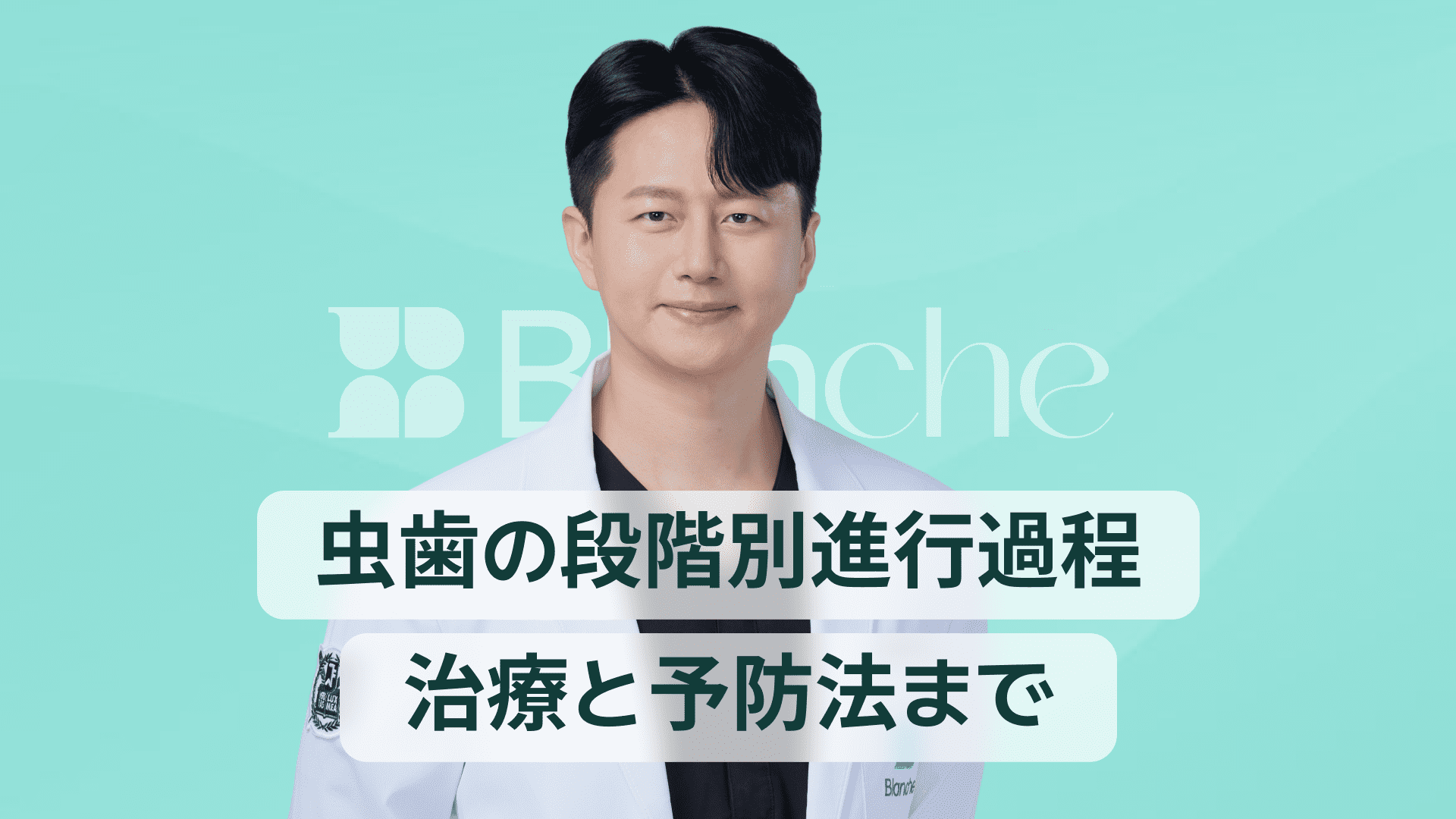 【韓国歯科】虫歯の段階的な進行過程から治療と予防法まで一目でわかる完璧ガイド