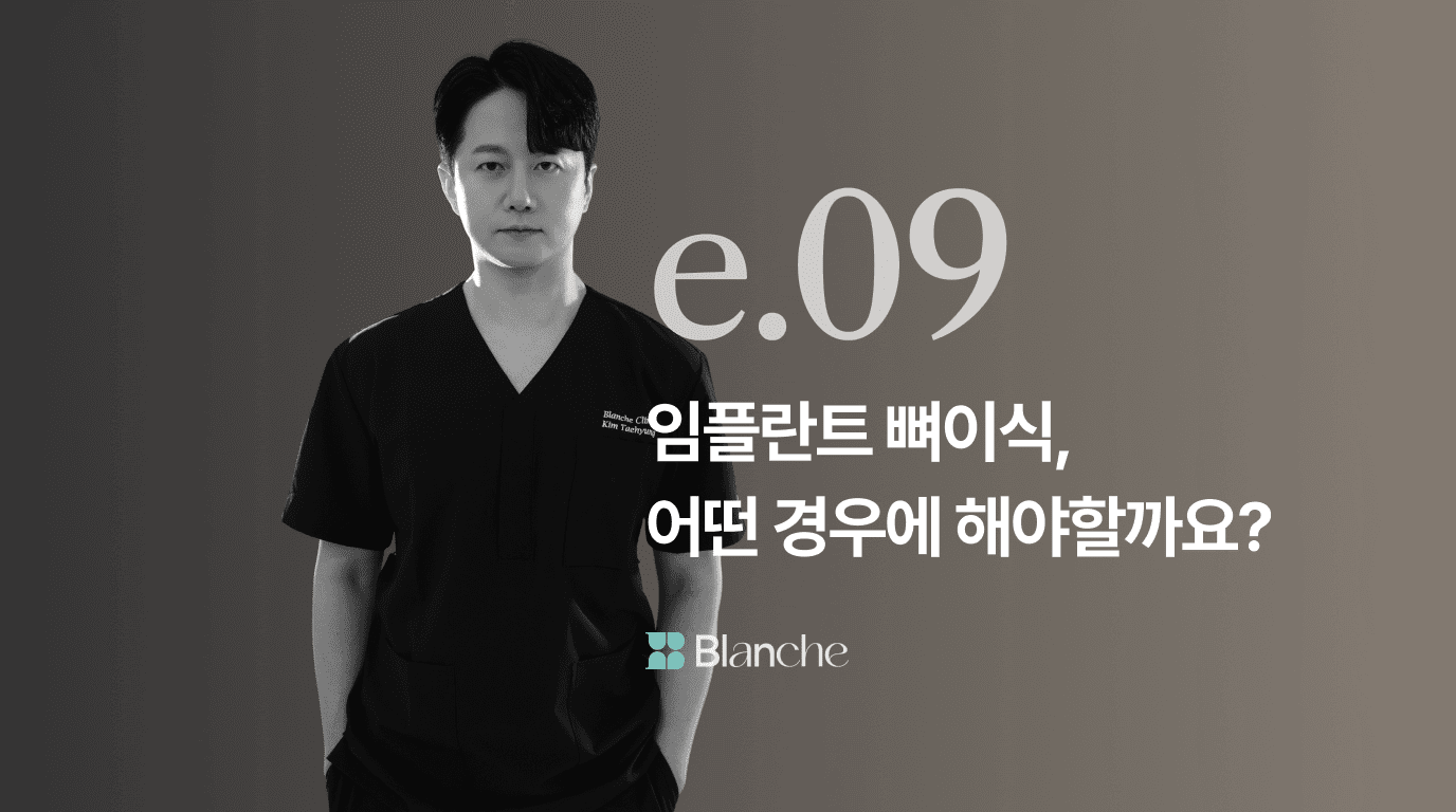 임플란트 뼈이식, 어떤 경우에 해야할까요? 정의, 재료, 추천대상 등