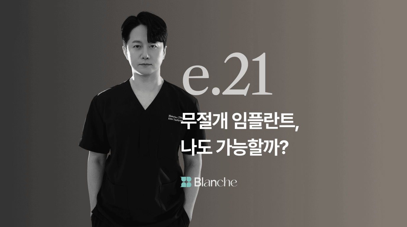 무절개 임플란트, 나도 가능할까?