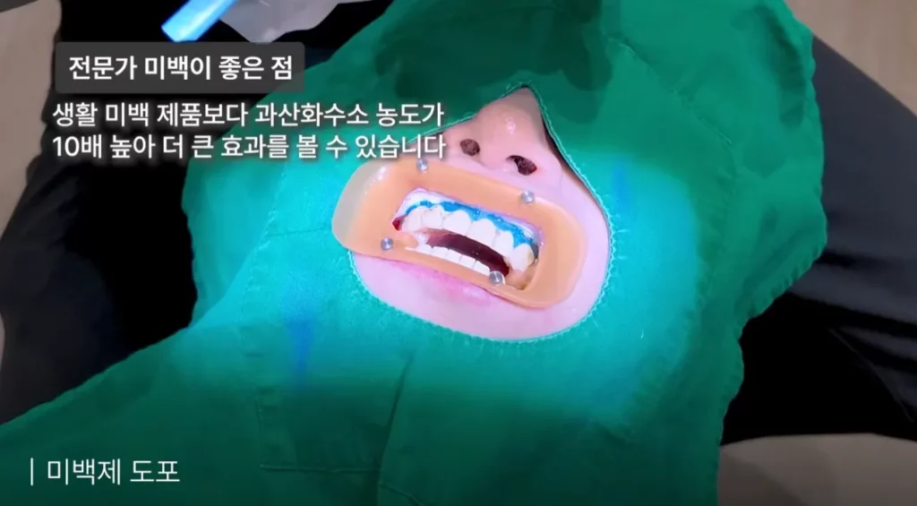 2.전문가 미백 시 고농도 미백제를 도포하는 치과 미백 시술 장면