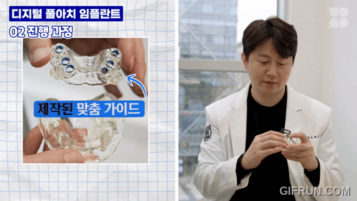 4. 임플란트 식립 · 임시 보철 연결