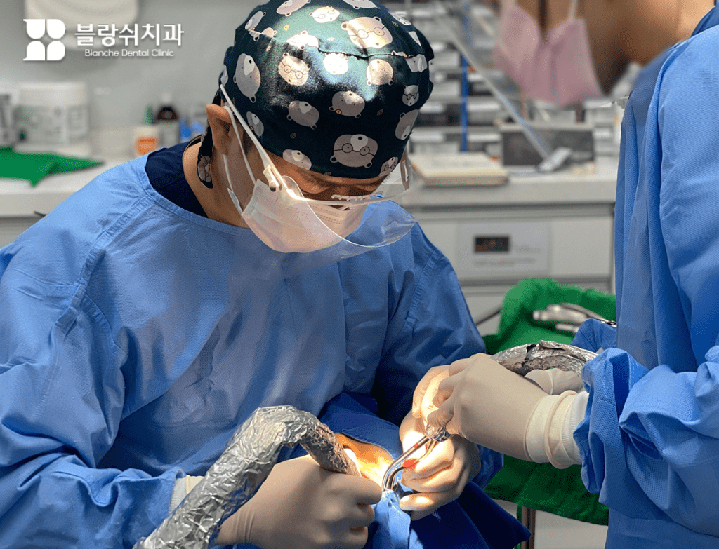 滅菌された手術着を着用したブランシュ歯科の医療スタッフが睡眠治療歯科システムを活用して患者のインプラント手術に集中している専門的な現場。