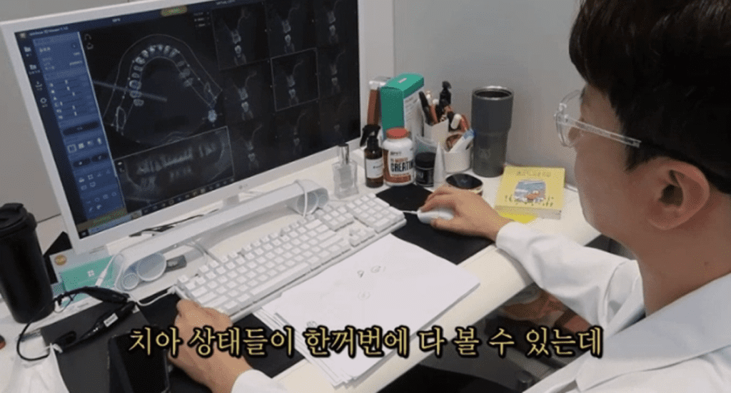 虫歯治療の選択基準4: CTなど最新の診断機器の活用を重視した画像