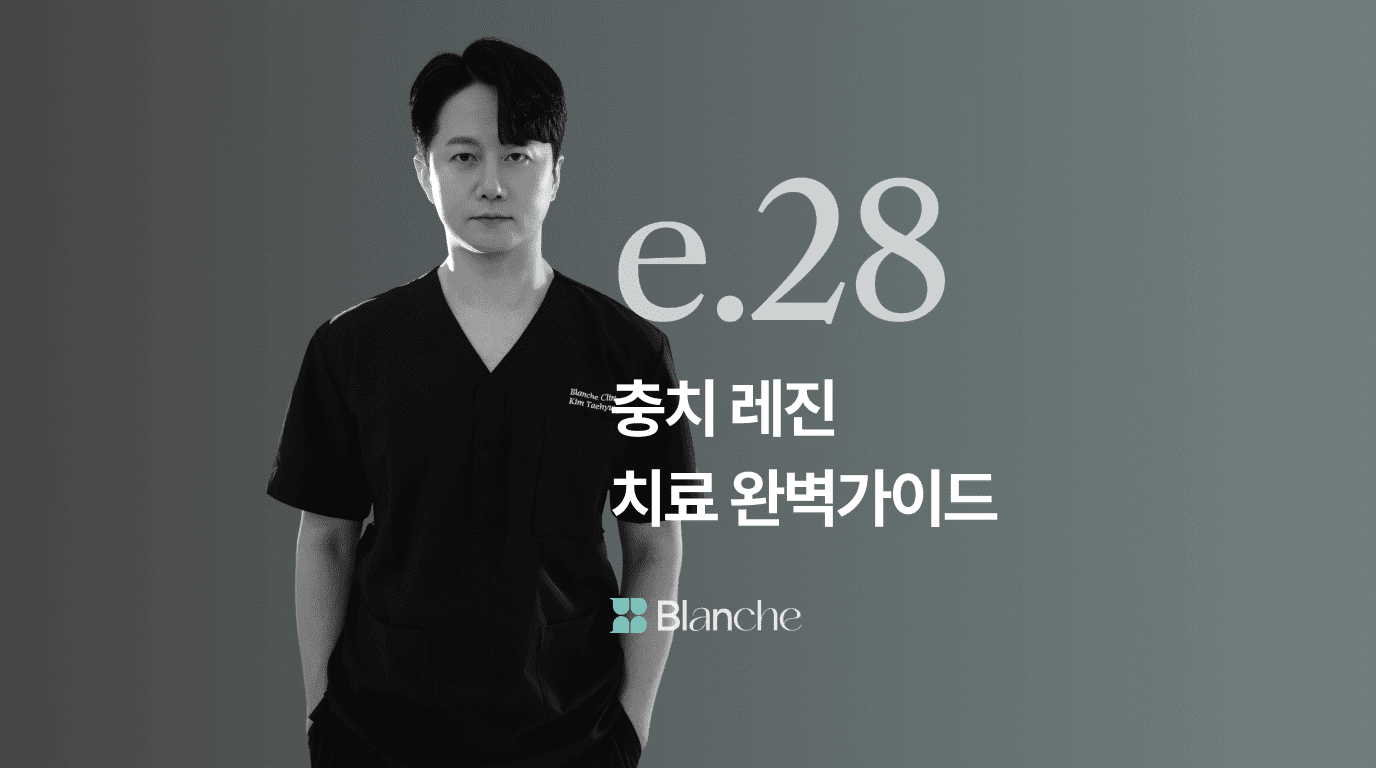 충치 레진 치료 완벽가이드 초기충치부터 비용까지 한눈에 끝내는 치과정보