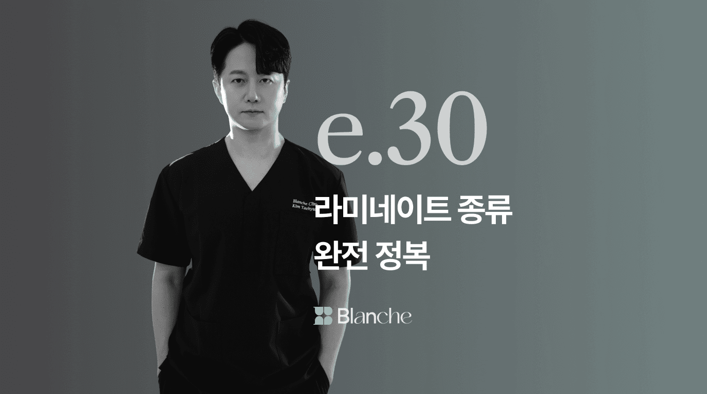 라미네이트 종류 완전정복 세라믹부터 컴포지트까지 비교하고 나에게 맞는 선택 찾기