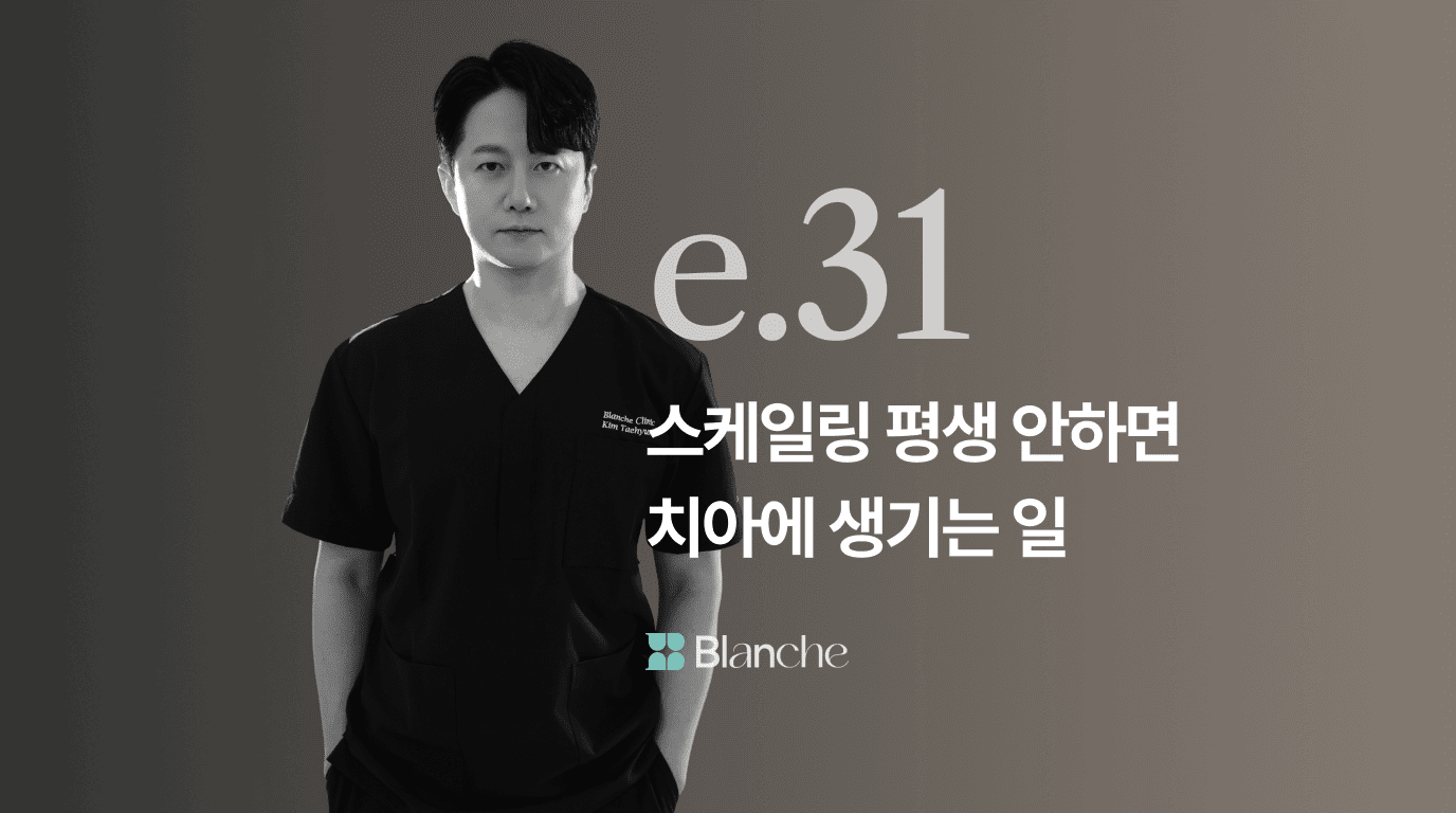 스케일링 안하는 사람에게 나타나는 충격적 변화 평생 방치하면 치아에 생기는 일