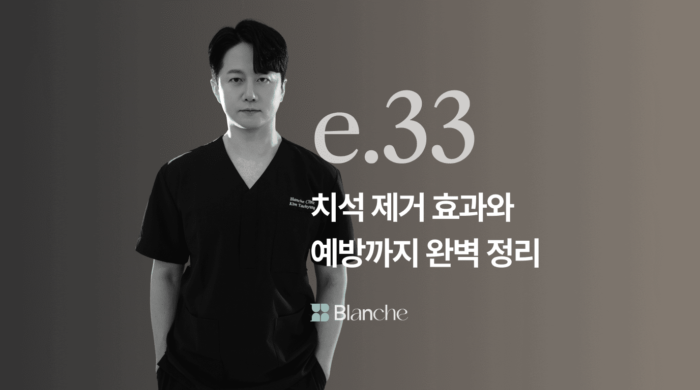 스케일링 치석 한 번으로 끝? 치석 제거 효과와 예방까지 완벽 정리