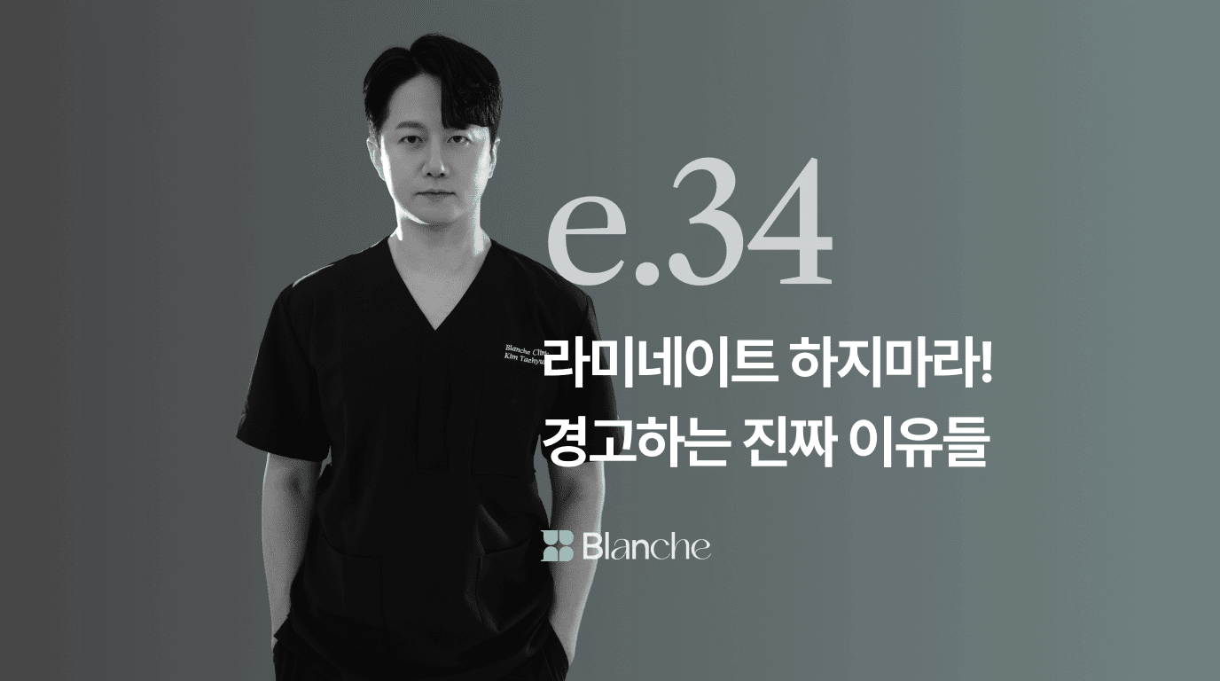 라미네이트 하지마라! 경고하는 진짜 이유들