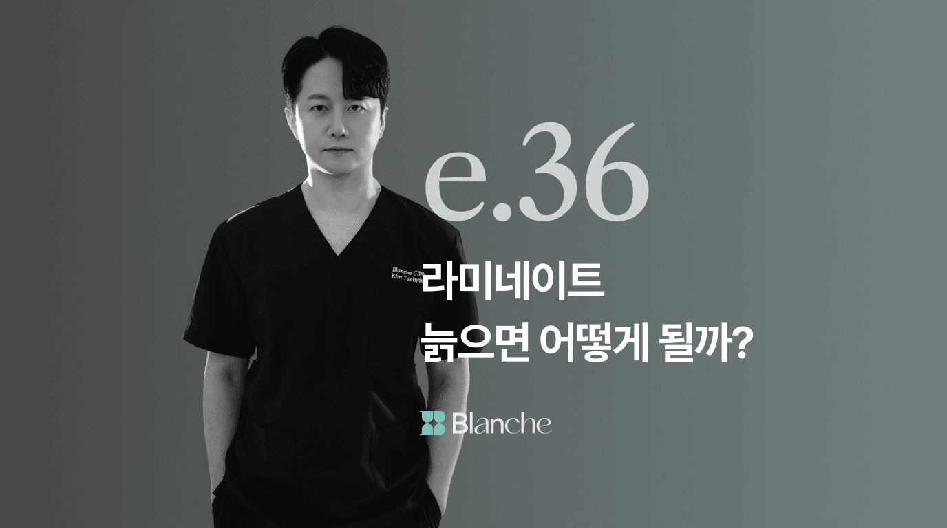 라미네이트 늙으면 어떻게 될까? 주요 변화와 재시술 주의점