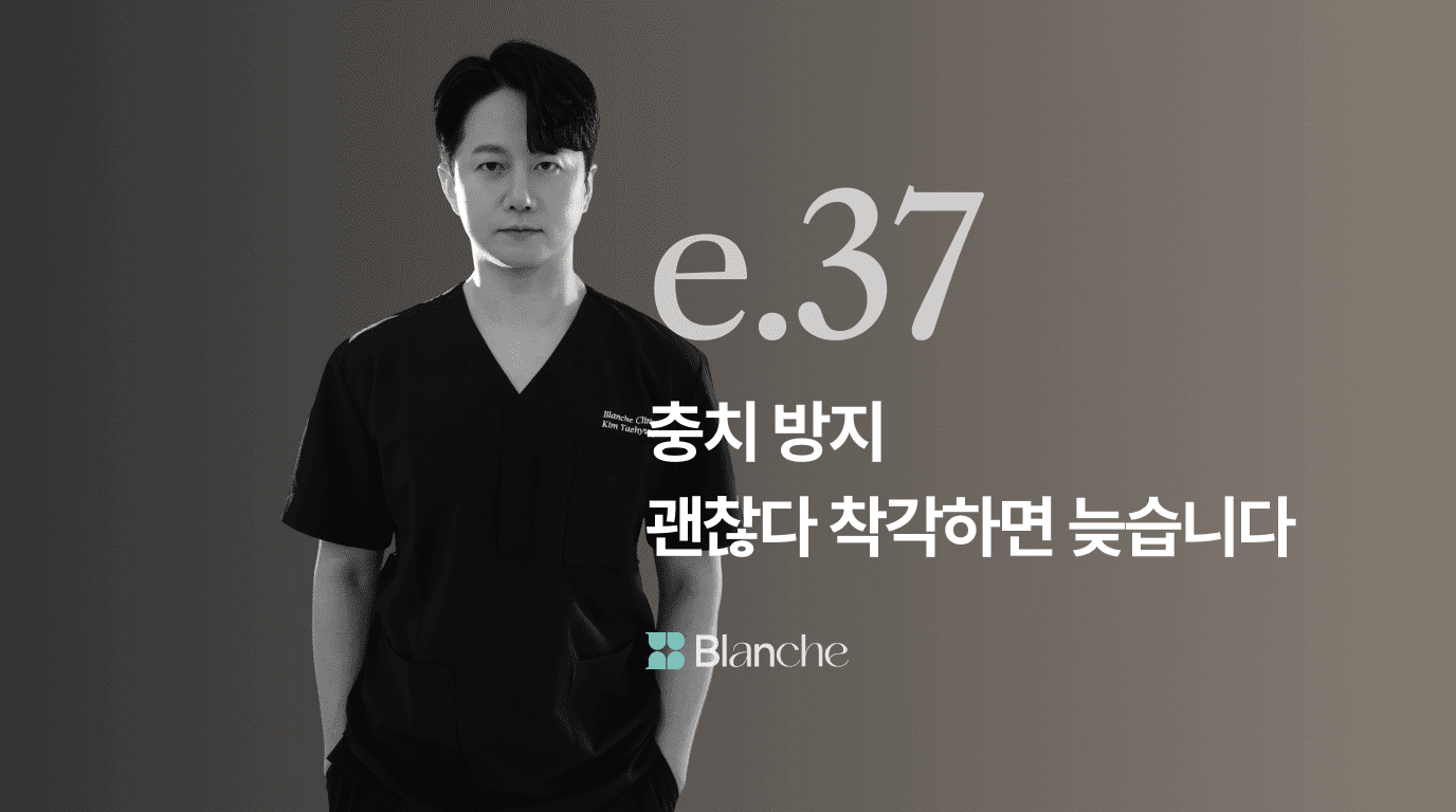 충치 방치 초기엔 괜찮다 착각하면 늦습니다 진행 단계별 증상과 치료 타이밍 총정리