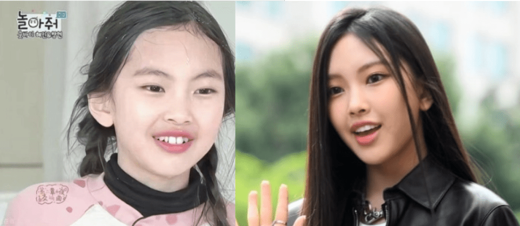 ラミネートで完成した整った歯を見せて笑うNewJeansヘインの姿