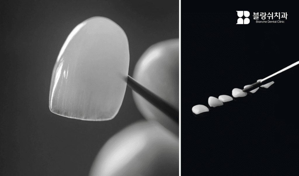 精巧に製作されたラミネートチップのディテールと配列