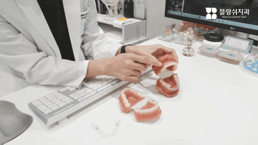 うさぎ歯を全体矯正で歯列と口元の突出感を改善する説明イメージ