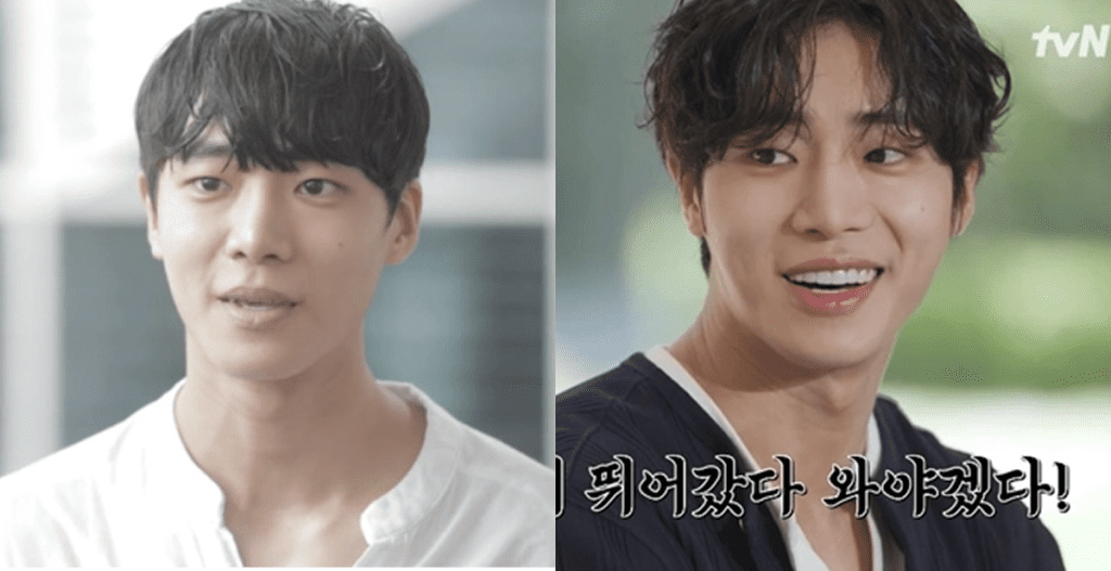 ラミネートの前後で印象がスッキリと改善された俳優チュ・ヨンウの変化