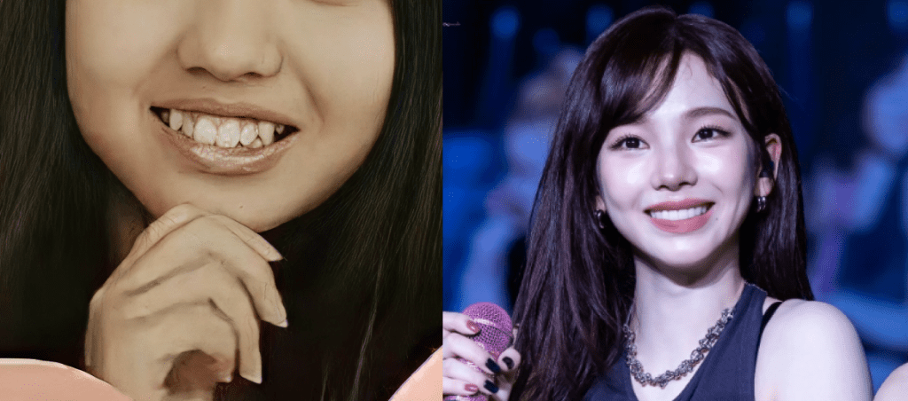 ラミネート施術前後の歯の対称性を比較したaespaカリナ