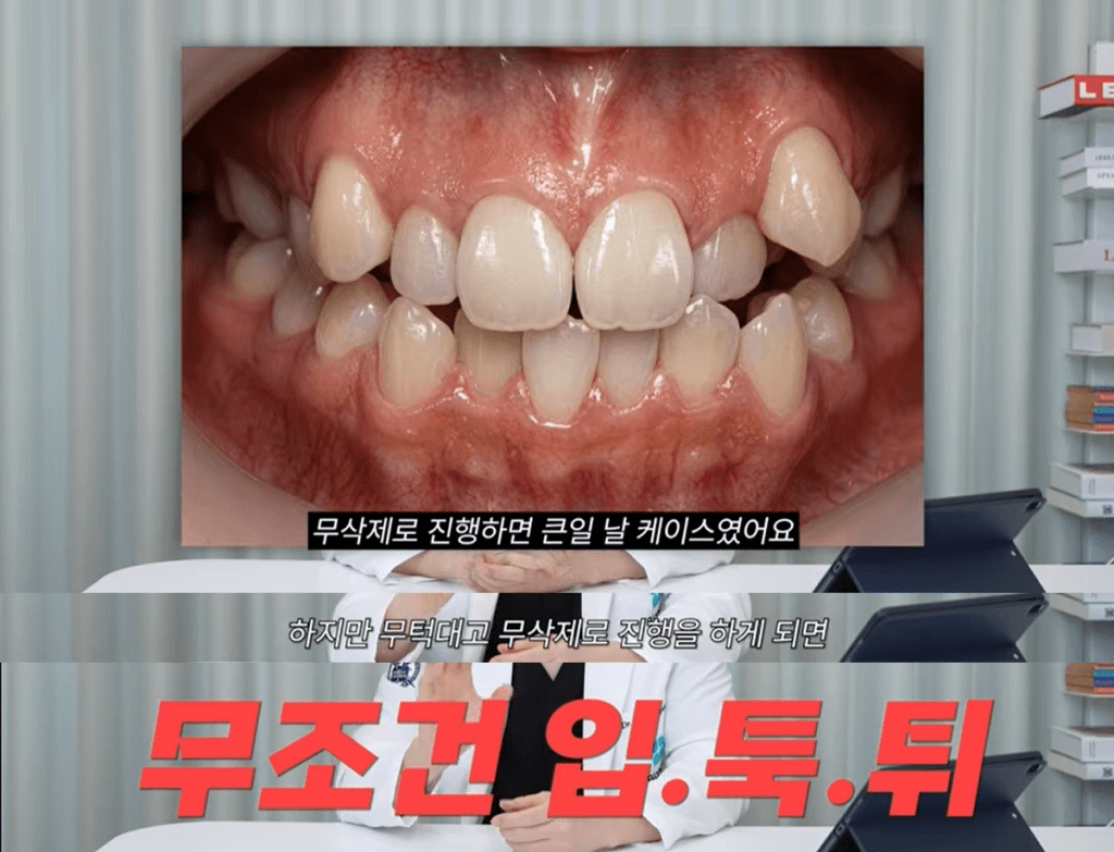 無削除ラミネート加工をしてはいけないケース