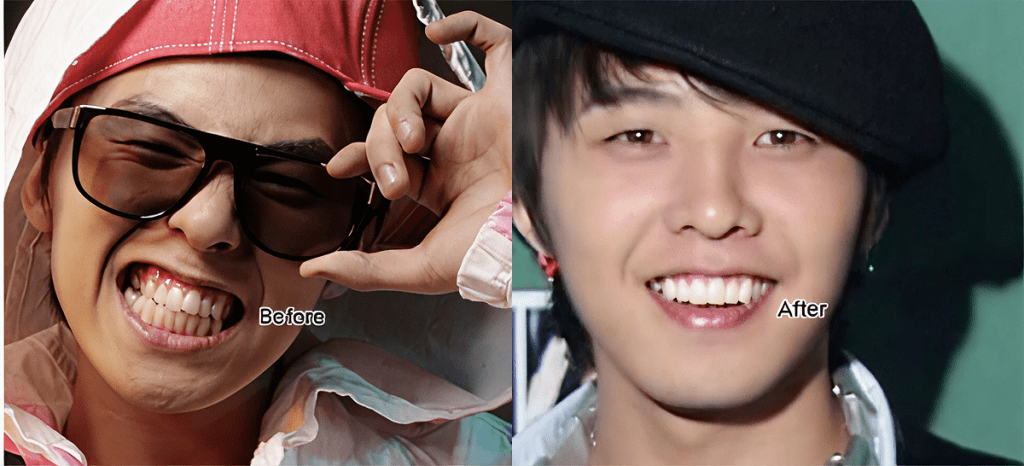 芸能人ラミネート前後比較、濃いサングラスと赤い衣装を着用したクォン・ジヨン(G-DRAGON)