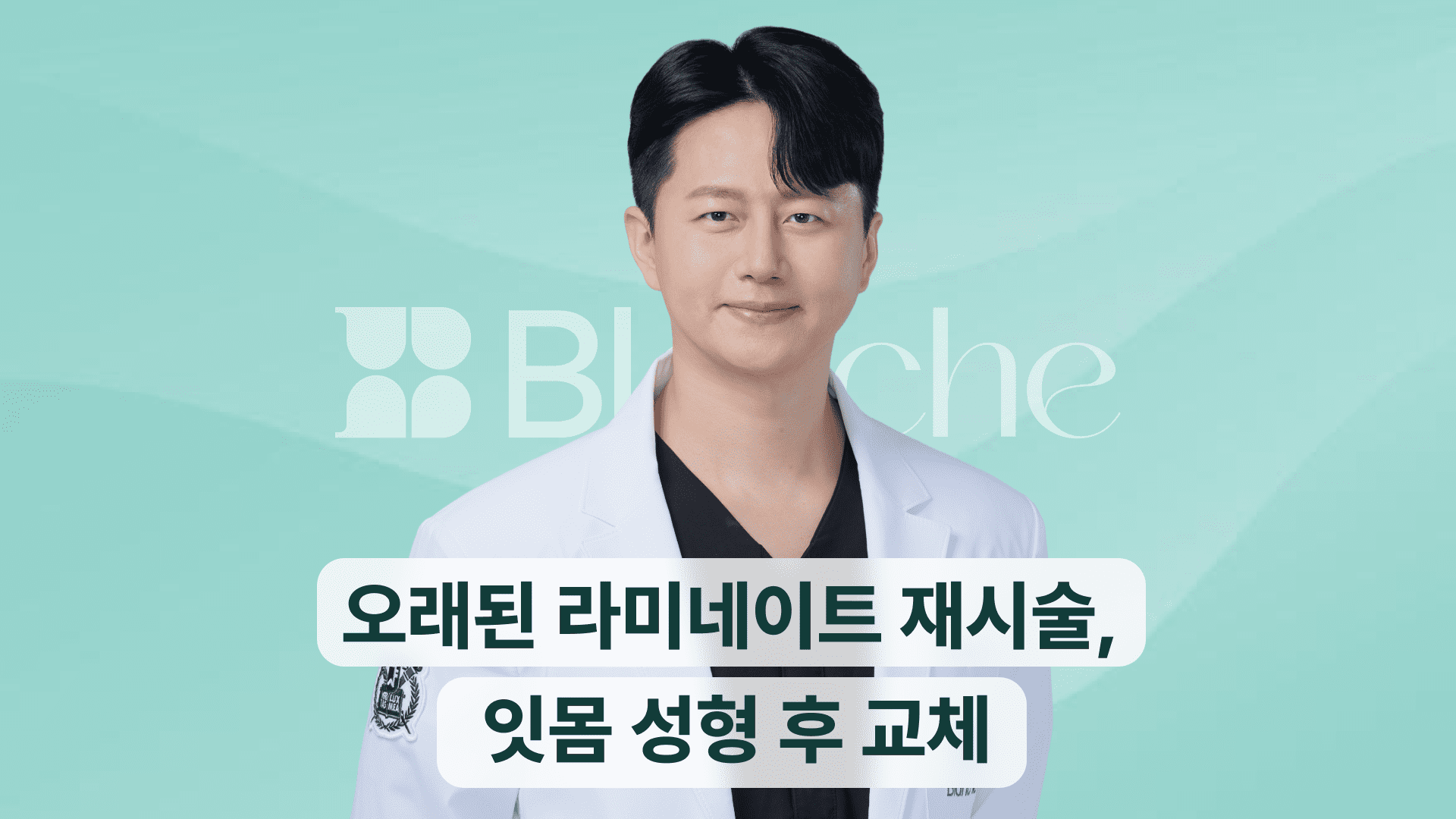 오래된 라미네이트 재시술, 잇몸 성형 후 교체