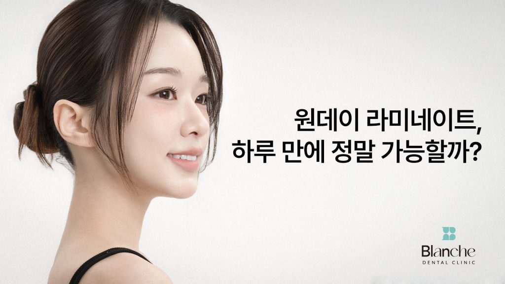 원데이 라미네이트, 하루 만에 가능할까?