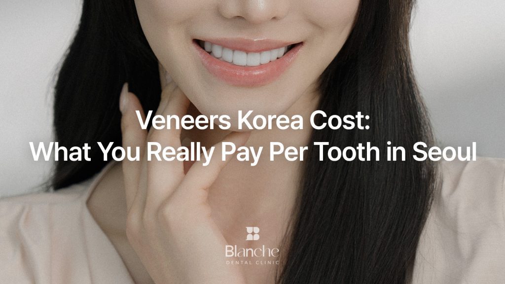 What You Really Pay Per Tooth in Seoul