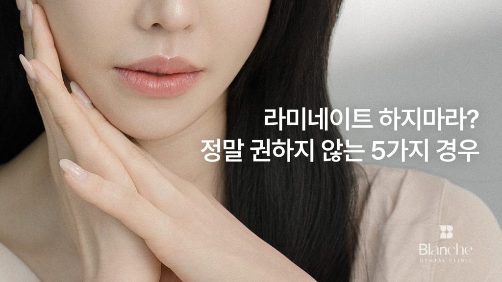 라미네이트 권하지 않는 5가지 경우