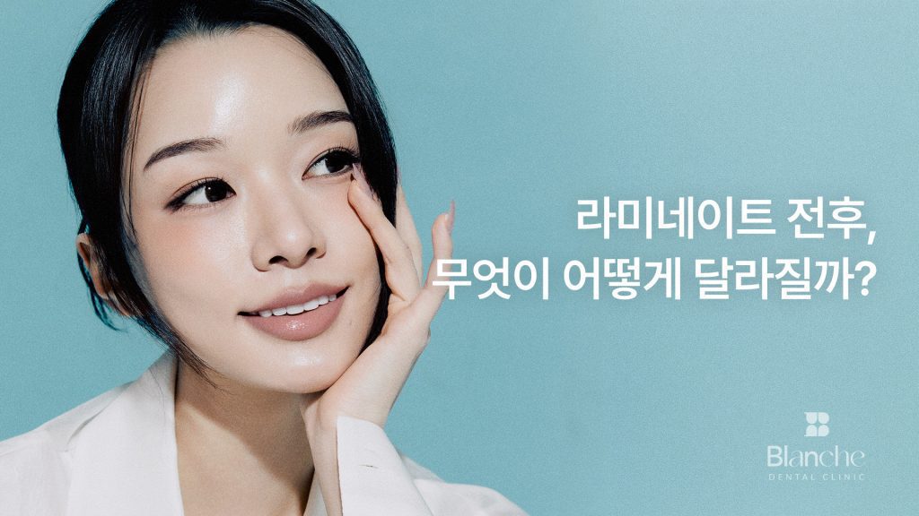 라미네이트 전후, 무엇이 어떻게 달라질까?