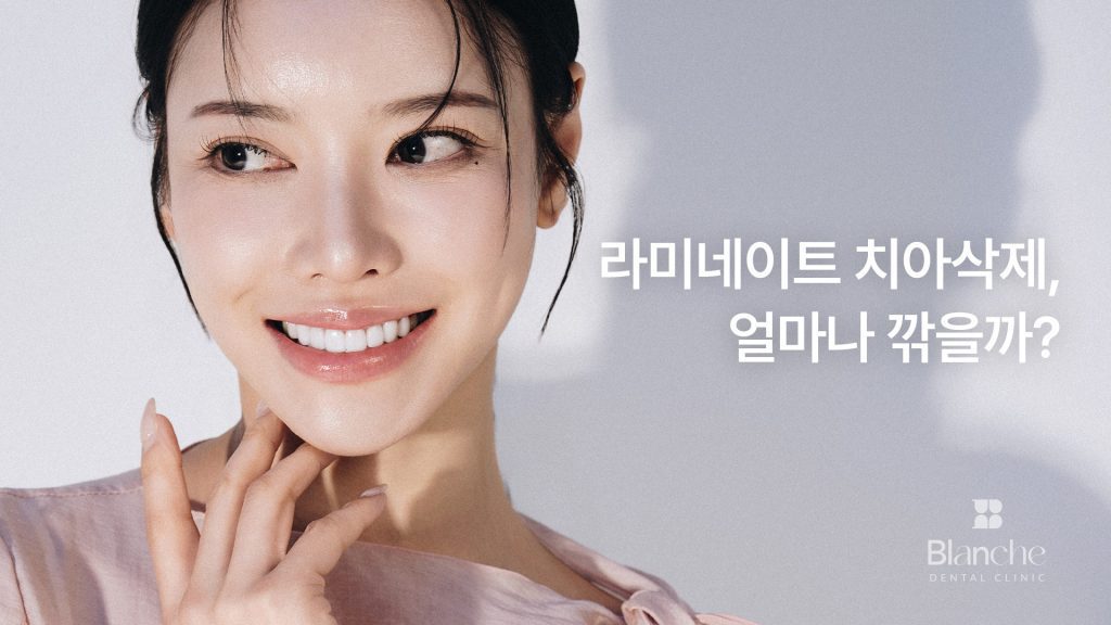 라미네이트 치아삭제, 얼마나 깎을까?