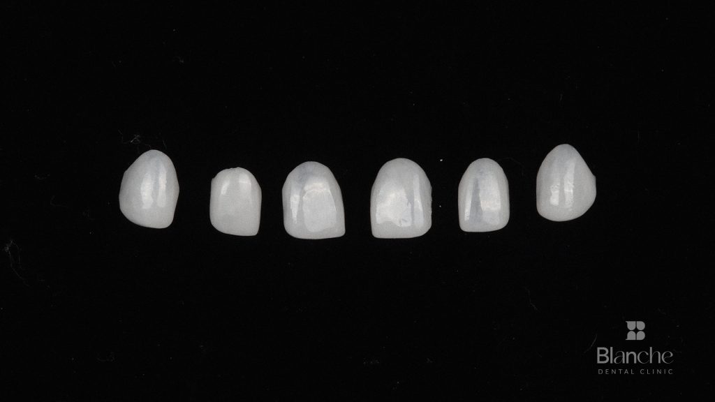 How many teeth do you actually need?