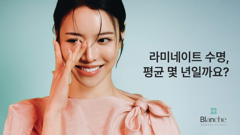 라미네이트 수명, 평균 몇 년?