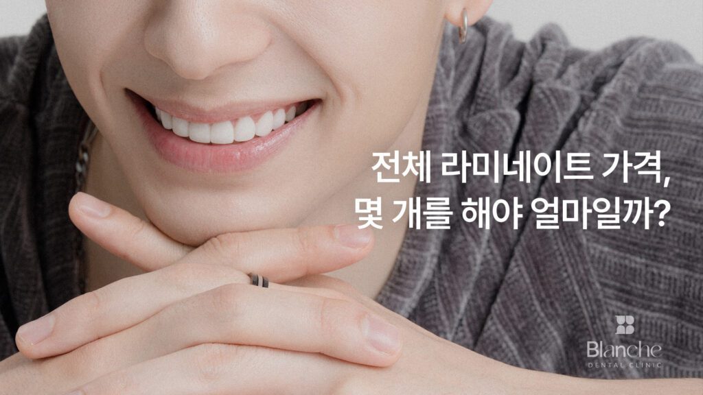 전체 라미네이트 가격, 범위별 기준 총정리