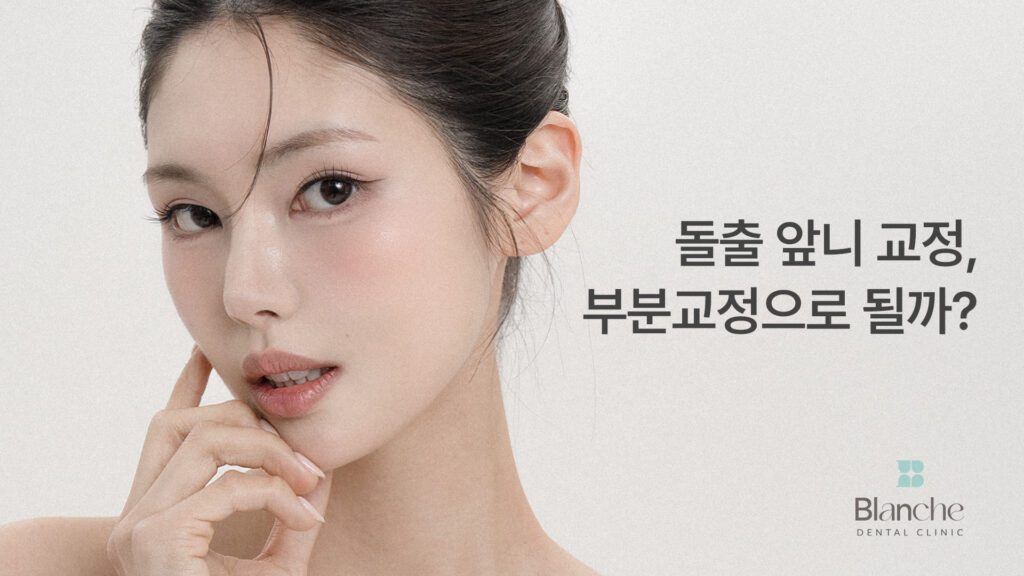 돌출 앞니 교정, 부분교정으로 될까?