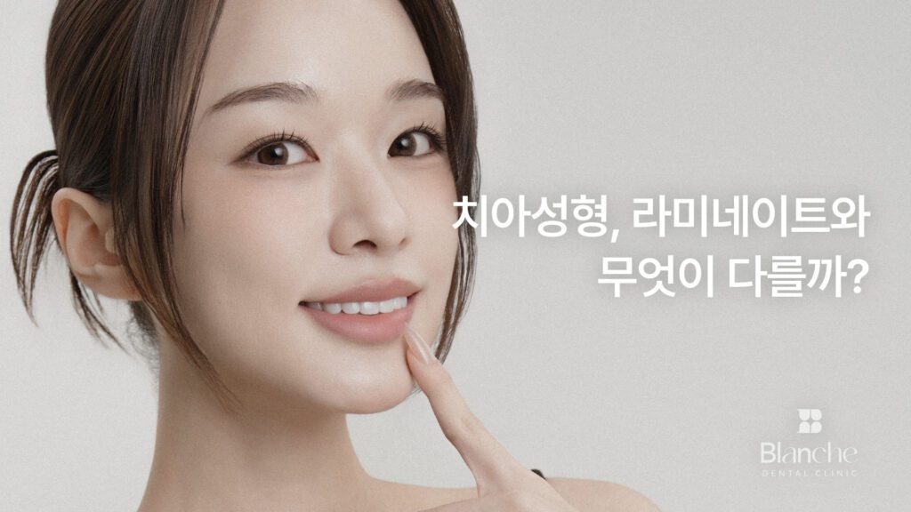 치아성형, 라미네이트와 무엇이 다를까?