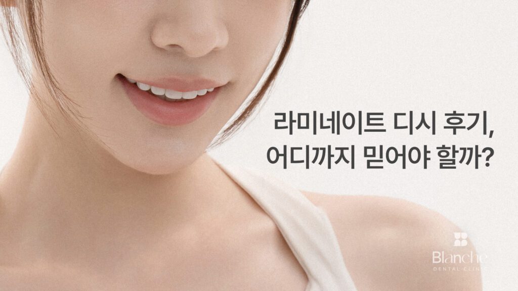 라미네이트 디시 후기, 어디까지 믿어야 할까?