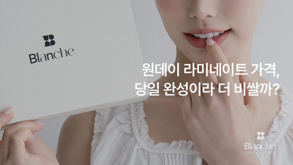 원데이 라미네이트 가격