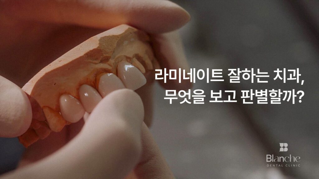 라미네이트 잘하는 치과