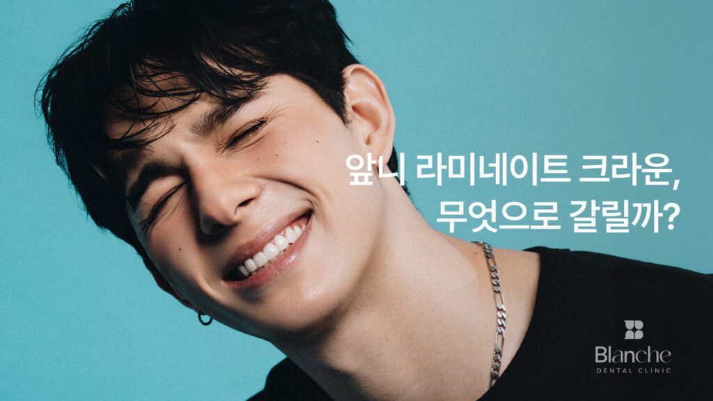 앞니 라미네이트 크라운, 무엇으로 갈릴까?