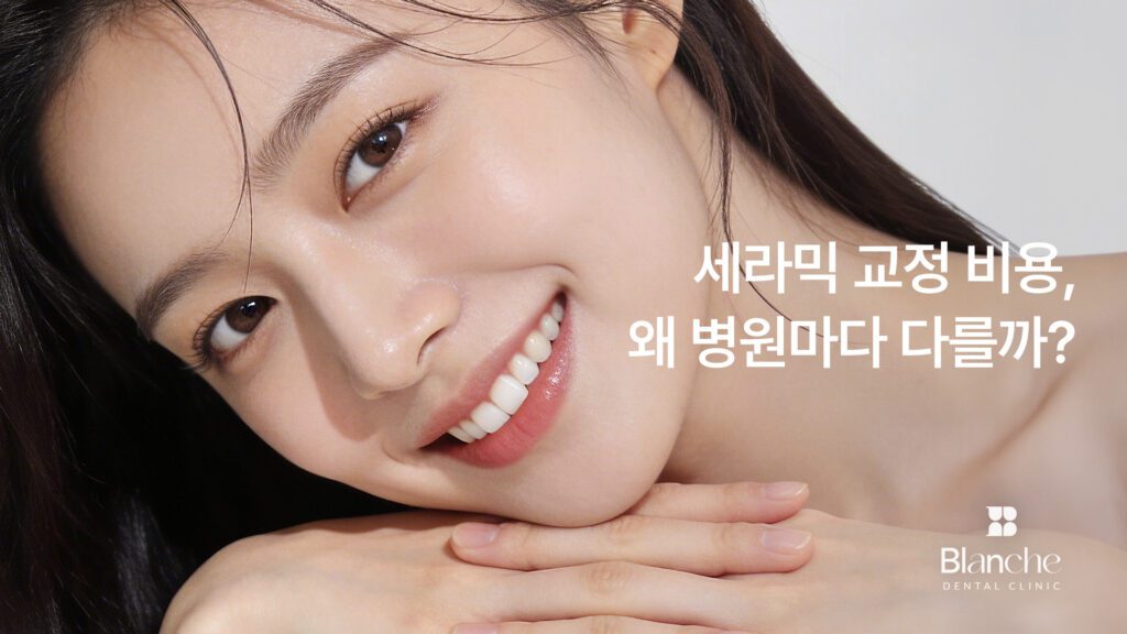 세라믹 교정 비용, 왜 병원마다 다를까?
