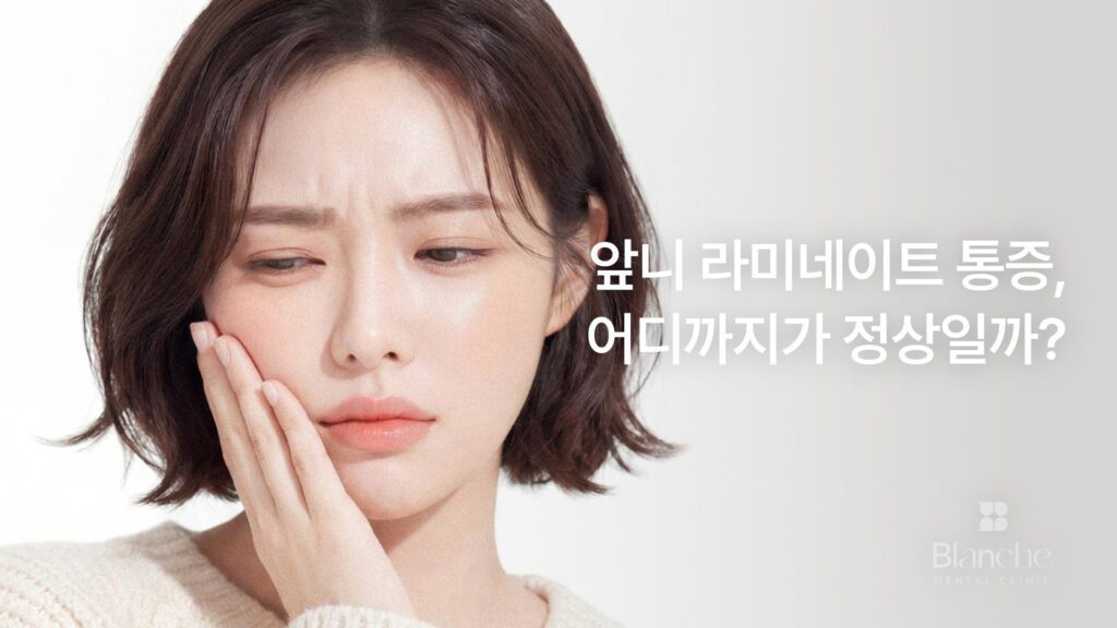 앞니 라미네이트 통증, 어디까지가 정상일까? 시기별 경과와 빠짐 신호까지