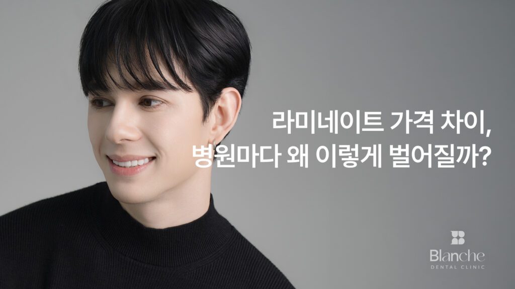 라미네이트 가격 차이, 병원마다 왜 이렇게 벌어질까?