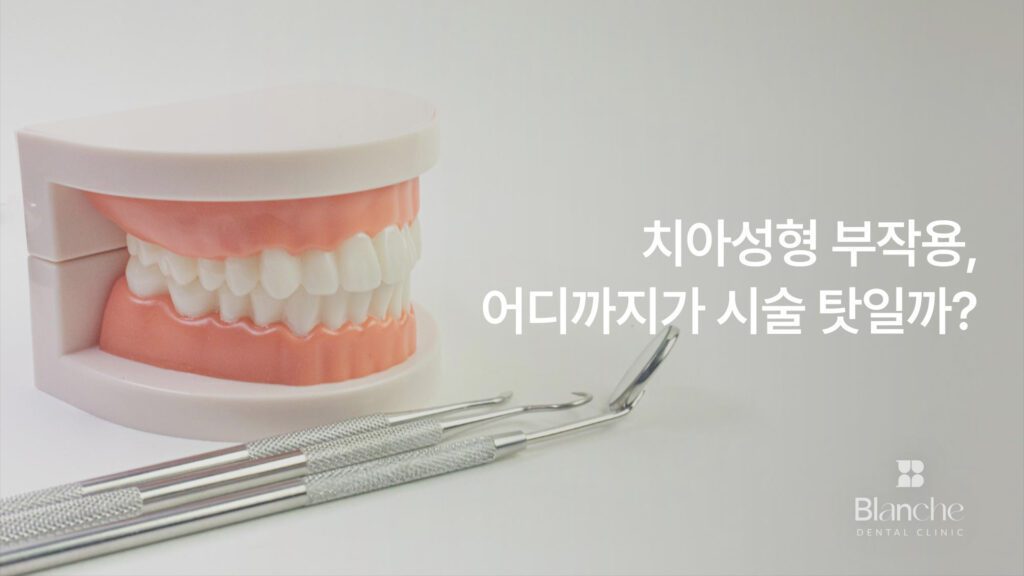 치아성형 부작용, 어디까지가 시술 탓일까?