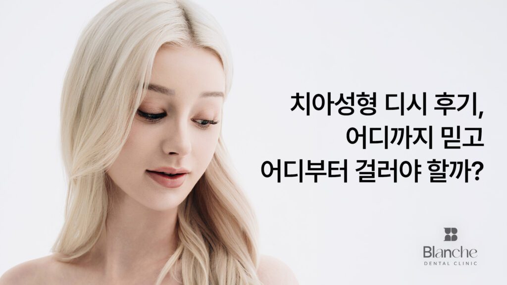 치아성형 디시 후기, 어디까지 믿고 어디부터 걸러야 할까?