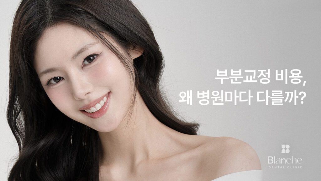 부분교정 비용, 왜 병원마다 다를까? 기간과 후회 사례까지 정리