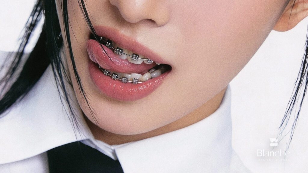 장치가 떨어졌다면, 지금 당장 할 일 3가지