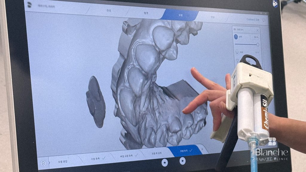 Step 2 — In-clinic exam and digital smile design (Day 1, morning)