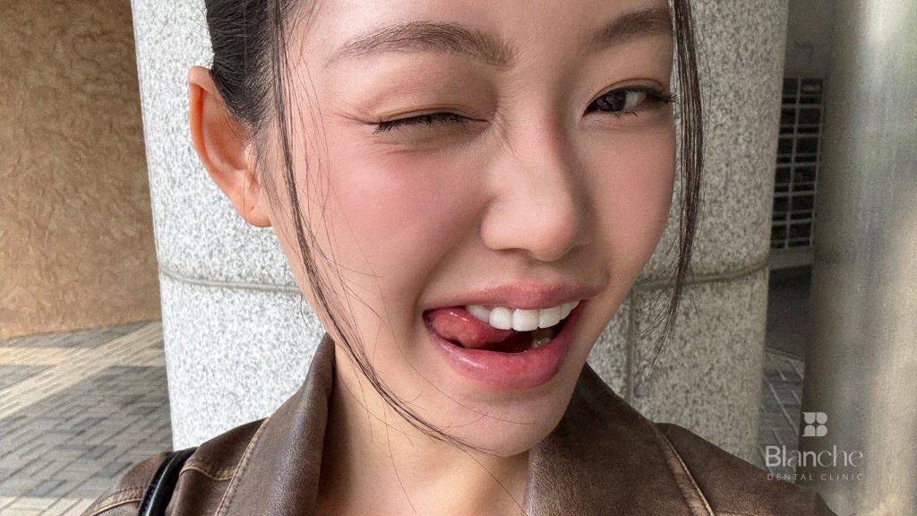 やり直しで失敗しないためのチェック4つ