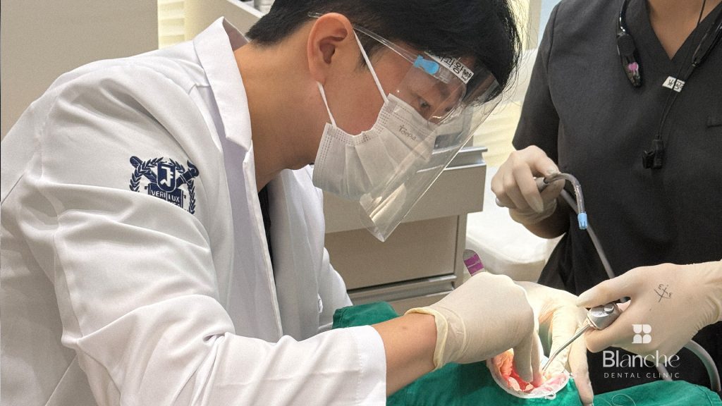 6-Point Checklist for Choosing a Gangnam Veneer Clinic